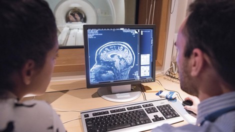 magnetna resonanca slika možgani disociacija