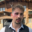 Žan Serčič v modricah: posnetek zdaj razkriva vse, kaj se je v resnici zgodilo