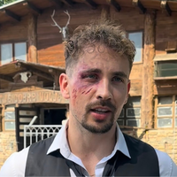 Žan Serčič v modricah: posnetek zdaj razkriva vse, kaj se je v resnici zgodilo