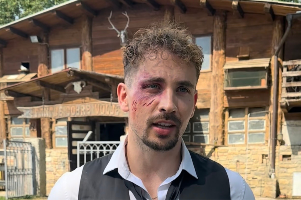 Žan Serčič v modricah: posnetek zdaj razkriva vse, kaj se je v resnici zgodilo (foto: Uredništvo)