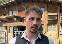 Žan Serčič v modricah: posnetek zdaj razkriva vse, kaj se je v resnici zgodilo