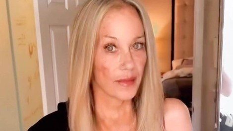 Christina Applegate v solzah o napačni diagnozi: "Spet sem na začetku!"