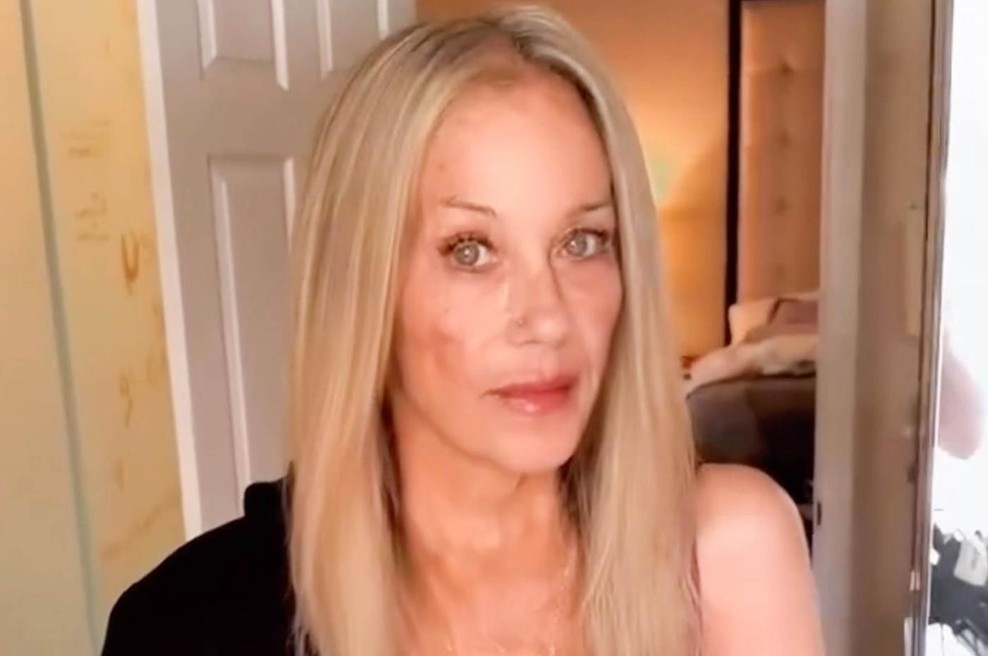 Christina Applegate v solzah o napačni diagnozi: "Spet sem na začetku!" (foto: profimedia)